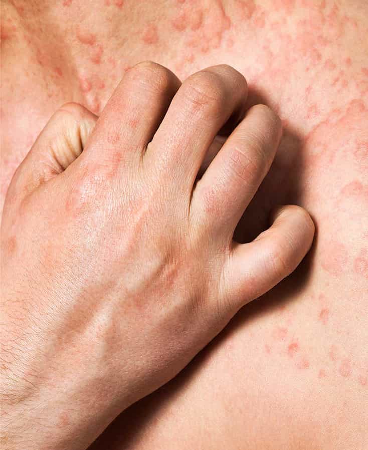Dermatología
